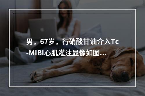 男，67岁，行硝酸甘油介入Tc-MIBI心肌灌注显像如图，可