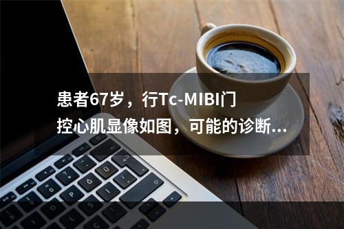 患者67岁，行Tc-MIBI门控心肌显像如图，可能的诊断是(