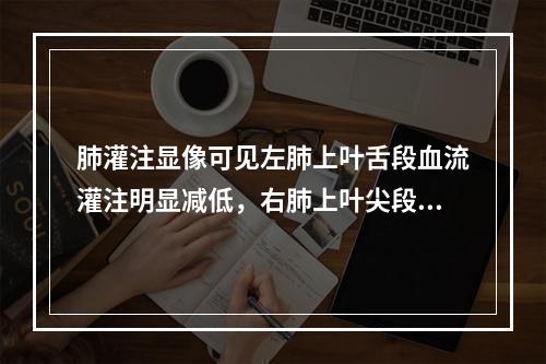 肺灌注显像可见左肺上叶舌段血流灌注明显减低，右肺上叶尖段血流