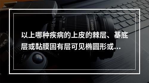 以上哪种疾病的上皮的棘层、基底层或黏膜固有层可见椭圆形或卵圆