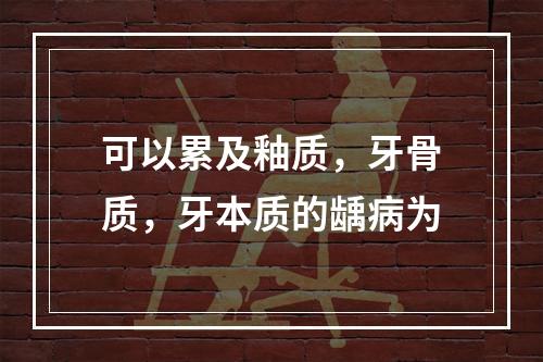 可以累及釉质，牙骨质，牙本质的龋病为