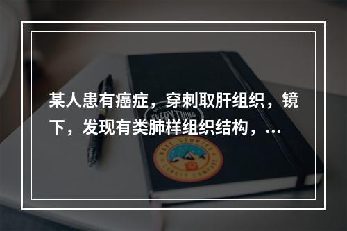 某人患有癌症，穿刺取肝组织，镜下，发现有类肺样组织结构，细胞