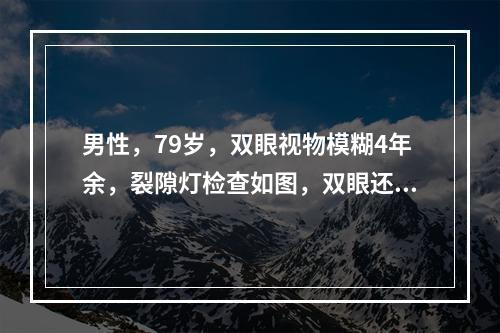 男性，79岁，双眼视物模糊4年余，裂隙灯检查如图，双眼还可能