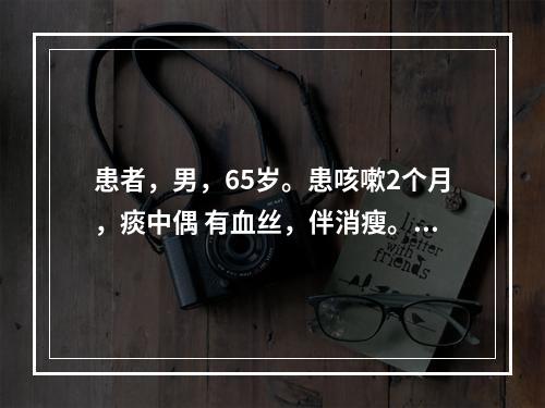 患者，男，65岁。患咳嗽2个月，痰中偶 有血丝，伴消瘦。胸片