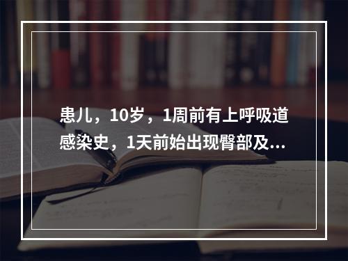 患儿，10岁，1周前有上呼吸道感染史，1天前始出现臀部及双下