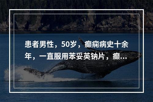 患者男性，50岁，癫痫病史十余年，一直服用苯妥英钠片，癫痫控