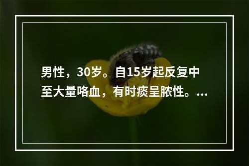 男性，30岁。自15岁起反复中至大量咯血，有时痰呈脓性。近日