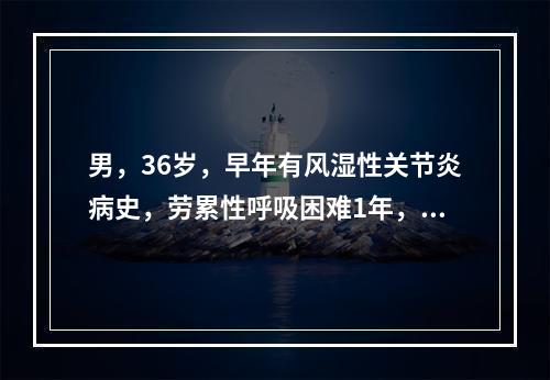 男，36岁，早年有风湿性关节炎病史，劳累性呼吸困难1年，近两