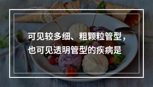 可见较多细、粗颗粒管型，也可见透明管型的疾病是