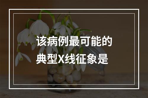 该病例最可能的典型X线征象是