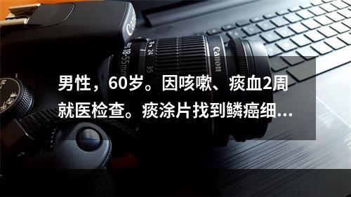 男性，60岁。因咳嗽、痰血2周就医检查。痰涂片找到鳞癌细胞，