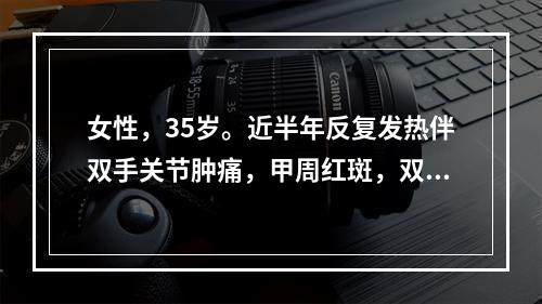 女性，35岁。近半年反复发热伴双手关节肿痛，甲周红斑，双下肢