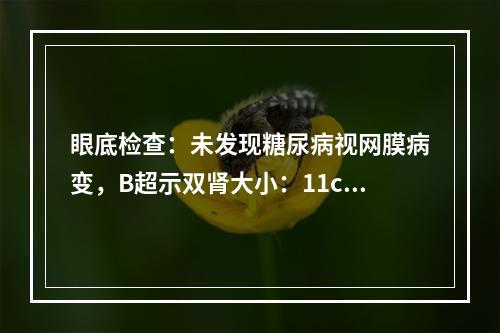 眼底检查：未发现糖尿病视网膜病变，B超示双肾大小：11cm×