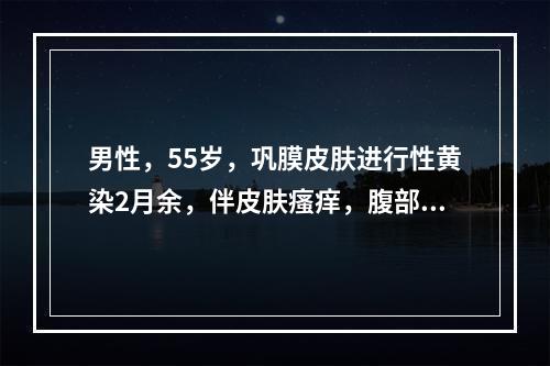 男性，55岁，巩膜皮肤进行性黄染2月余，伴皮肤瘙痒，腹部检查