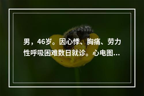 男，46岁。因心悸、胸痛、劳力性呼吸困难数日就诊。心电图示左