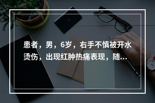 患者，男，6岁，右手不慎被开水烫伤，出现红肿热痛表现，随之出