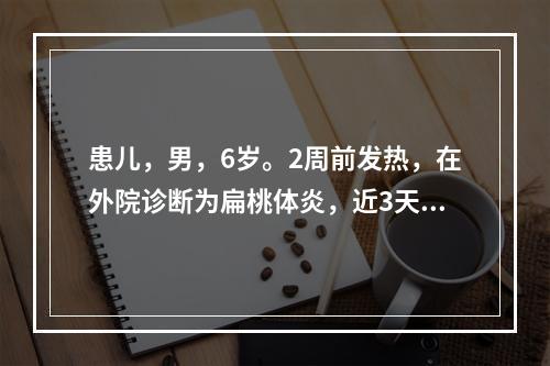 患儿，男，6岁。2周前发热，在外院诊断为扁桃体炎，近3天尿量