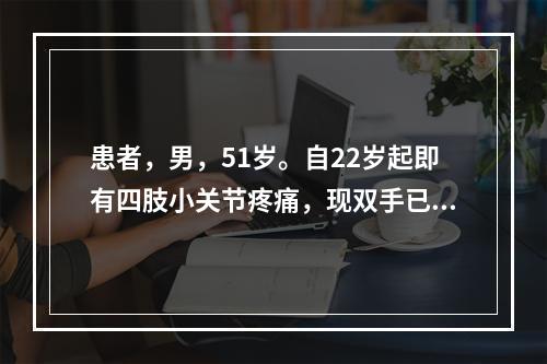 患者，男，51岁。自22岁起即有四肢小关节疼痛，现双手已有畸