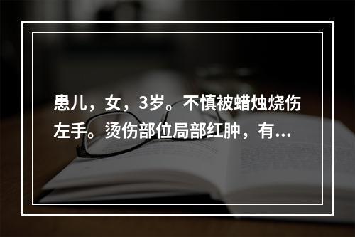 患儿，女，3岁。不慎被蜡烛烧伤左手。烫伤部位局部红肿，有一个