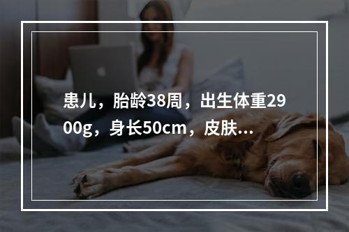 患儿，胎龄38周，出生体重2900g，身长50cm，皮肤红润