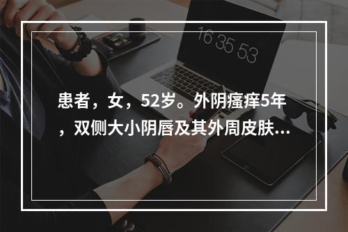 患者，女，52岁。外阴瘙痒5年，双侧大小阴唇及其外周皮肤充血