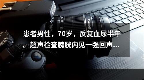 患者男性，70岁，反复血尿半年。超声检查膀胱内见一强回声团，