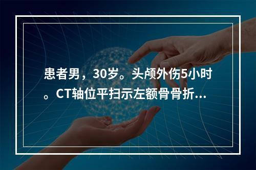 患者男，30岁。头颅外伤5小时。CT轴位平扫示左额骨骨折，头