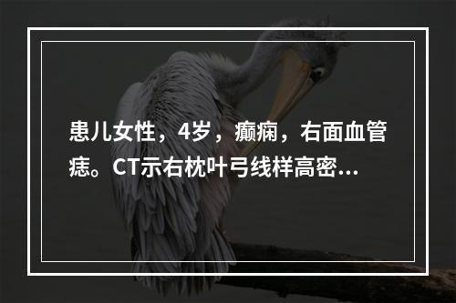 患儿女性，4岁，癫痫，右面血管痣。CT示右枕叶弓线样高密度，