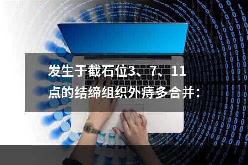 发生于截石位3、7、11点的结缔组织外痔多合并：