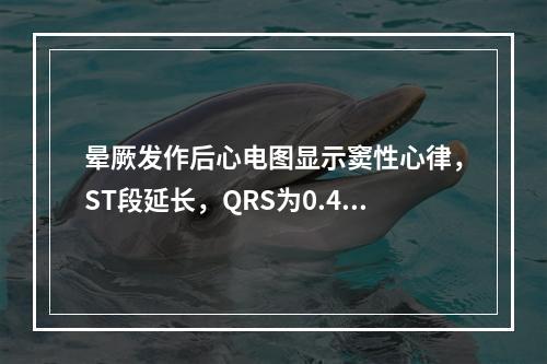 晕厥发作后心电图显示窦性心律，ST段延长，QRS为0.48秒