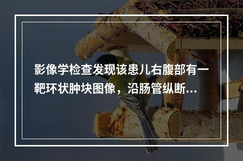 影像学检查发现该患儿右腹部有一靶环状肿块图像，沿肠管纵断扫描