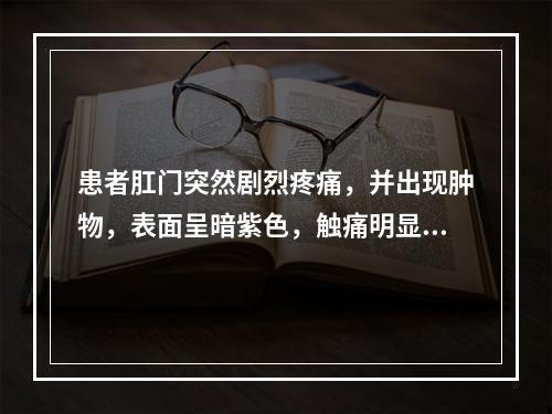 患者肛门突然剧烈疼痛，并出现肿物，表面呈暗紫色，触痛明显，其