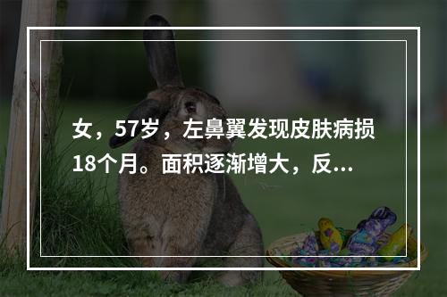 女，57岁，左鼻翼发现皮肤病损18个月。面积逐渐增大，反复出