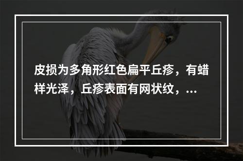 皮损为多角形红色扁平丘疹，有蜡样光泽，丘疹表面有网状纹，其诊