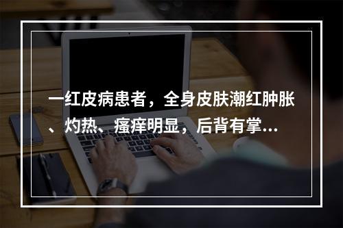 一红皮病患者，全身皮肤潮红肿胀、灼热、瘙痒明显，后背有掌大皮