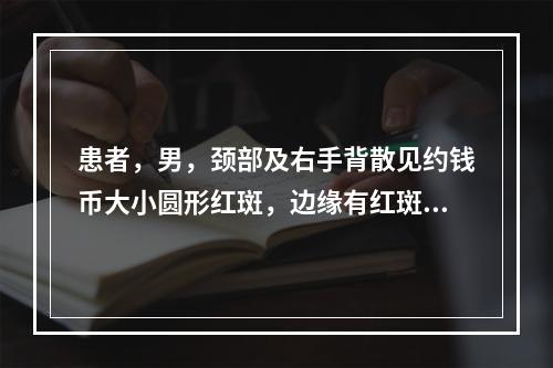 患者，男，颈部及右手背散见约钱币大小圆形红斑，边缘有红斑、丘