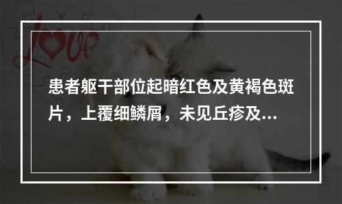 患者躯干部位起暗红色及黄褐色斑片，上覆细鳞屑，未见丘疹及渗出