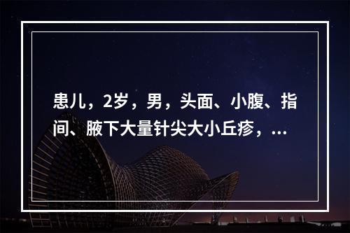 患儿，2岁，男，头面、小腹、指间、腋下大量针尖大小丘疹，入夜