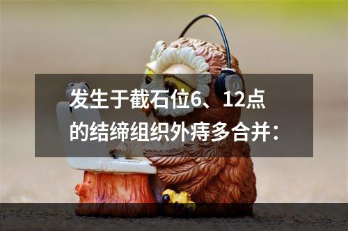 发生于截石位6、12点的结缔组织外痔多合并：