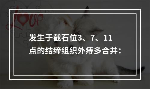 发生于截石位3、7、11点的结缔组织外痔多合并：