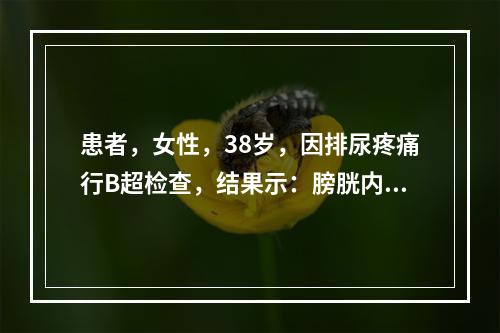 患者，女性，38岁，因排尿疼痛行B超检查，结果示：膀胱内结石