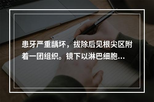 患牙严重龋坏，拔除后见根尖区附着一团组织。镜下以淋巴细胞、浆