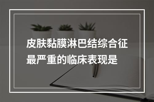 皮肤黏膜淋巴结综合征最严重的临床表现是