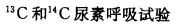 以下方法中，哪一种不能确定目前存在幽门螺杆菌感染()