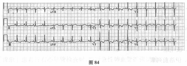 （提示：患者经治疗后好转出院，定期随访。）定期随访的评估内容