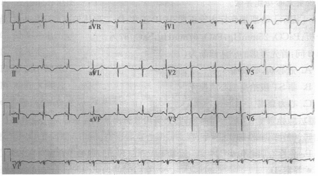 由该心电图可得到的信息有（）