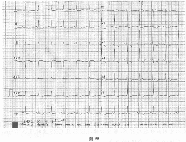 该患者应当考虑的疾病有（）