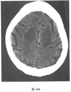 (提示实验室检查：血RBC2.09×10/L，Hb88.0g