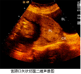 合适的临床处理方式有(提示超声：胎儿结构无异常。)